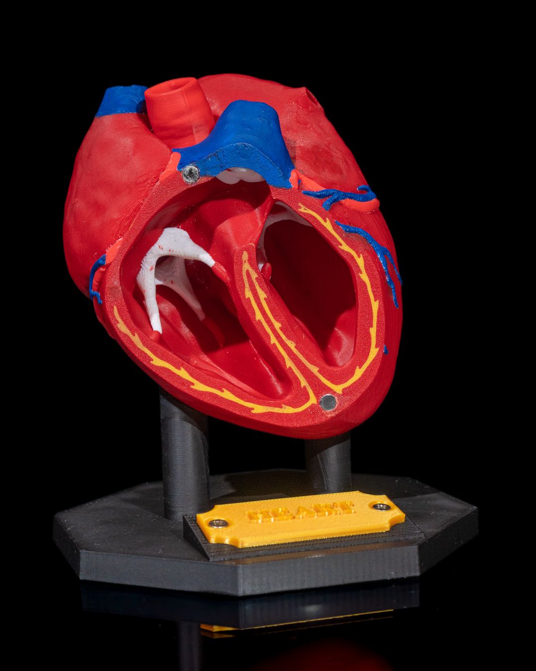 Heart Anatomical Model | 3D Printer Model Files