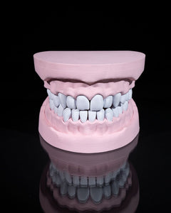Upper and Lower Dental Arch | 3D Print Model