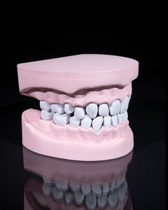 Upper and Lower Dental Arch | 3D Print Model